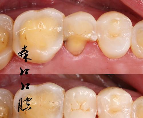 如何有效地恢复一个破碎的接口（探索接口修复的方法和技巧）